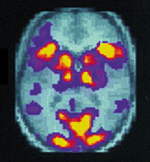 Physics looks at the brain